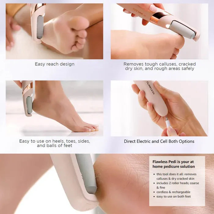 Electric Feet Callus Remover